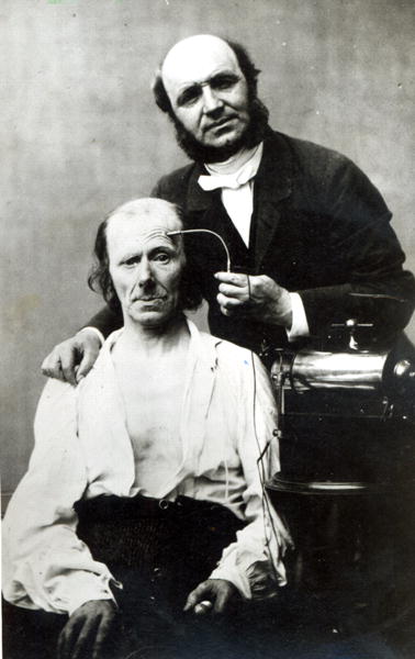 Duchenne de Boulogne with a ''victim patient'', 1862 (b/w photo)  de French Photographer