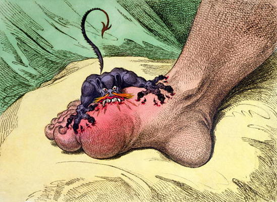 The Gout, published by Hannah Humphrey in 1799 (hand-coloured softdground etching) de James Gillray