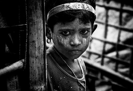 Rohingya girl - Bangladesh