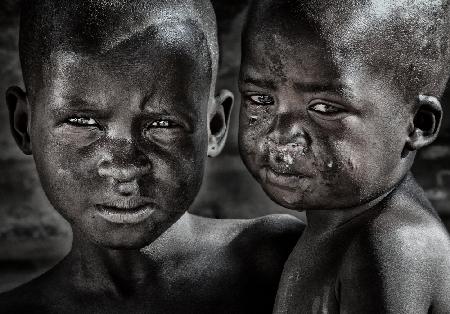 Two brothers in a slum in Juba - South Sudan